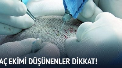 Devlet Hastanesinde Saç Ekimi Yapılır Mı