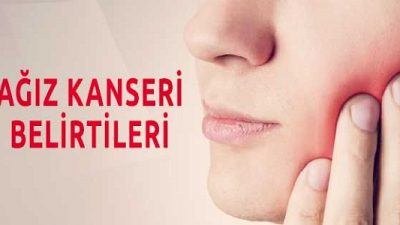 Ağız Kanseri Nedir? Ağız Kanseri Belirtileri Nelerdir?