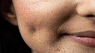 Devlet Hastanesinde Gamze Estetiği Fiyatları